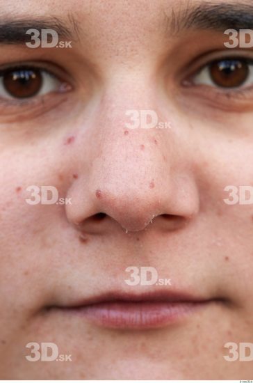 Neck Head Woman Birthmarks Slim Average Street photo references