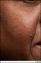 Korah Wilkerson HD Face Skin